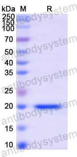 Recombinant Human CD62P/SELP Protein, N-His