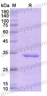 Recombinant Human CD104/ITGB4 Protein, N-His