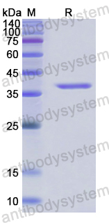 Recombinant Human CD104/ITGB4 Protein, N-His