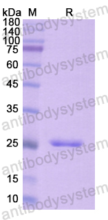 Recombinant Human CD43/SPN Protein, N-His