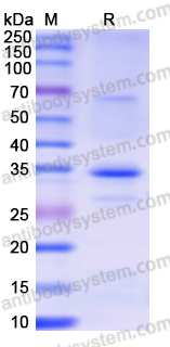Recombinant Human CBR1 Protein, N-His
