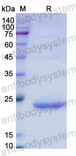 Recombinant Human ACADS Protein, N-His