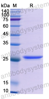 Recombinant Human CD140a/PDGFRA Protein, N-His