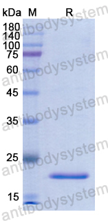 Recombinant Human GLB1 Protein, N-His