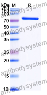 Recombinant Human GLB1/Beta-galactosidase Protein, N-His