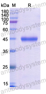 Recombinant Human NCK1 Protein, N-His