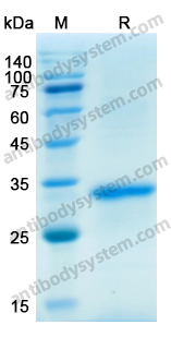 Recombinant Human CD326/EPCAM Protein, N-His