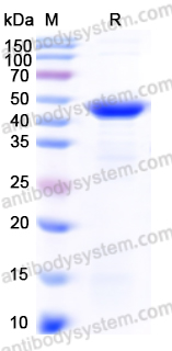 Recombinant Human POR Protein, N-His