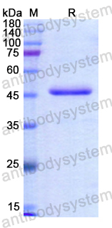 Recombinant Human DPEP1 Protein, N-His