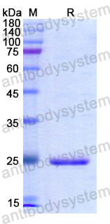 Recombinant Human MGMT Protein, N-His