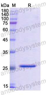 Recombinant Human PRLR Protein, N-His