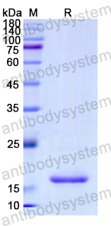 Recombinant Human PCSK2 Protein, N-His