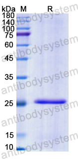 Recombinant Human CRISP2 Protein, N-His