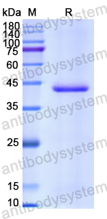 Recombinant Human CD62E/SELE Protein, N-His