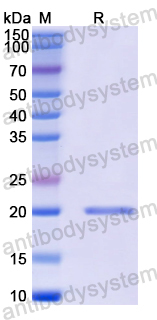 Recombinant Human CCL3L1 Protein, N-His-SUMO