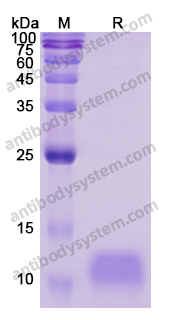 Recombinant Human NT-proBNP Protein, N-His