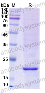 Recombinant Human CPE Protein, N-His