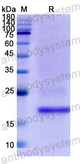 Recombinant Human FAH Protein, N-His