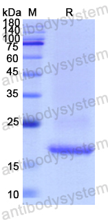 Recombinant Human STMN1 Protein, N-His