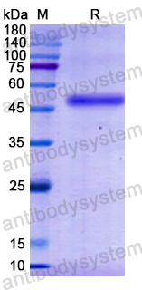 Recombinant Human GOT1 Protein, N-His