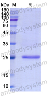 Recombinant Human IFNAR1 Protein, N-His