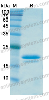 Recombinant Human CX43/GJA1 Protein, N-His