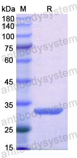 Recombinant Human SMPD1 Protein, N-His