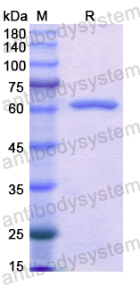 Recombinant Human AKR1C4 Protein, N-GST