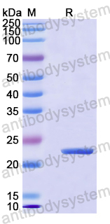 Recombinant Human NDUFB7 Protein, N-His-SUMO