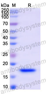 Recombinant Human SYN1 Protein, N-His