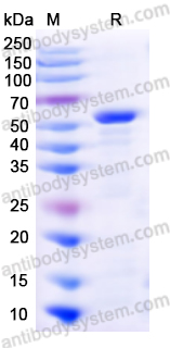 Recombinant Human CAPN2 Protein, N-His