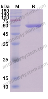 Recombinant Human DES/Desmin Protein, N-His