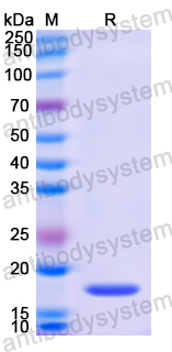 Recombinant Human CEBPB Protein, N-His