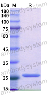 Recombinant Human GAP43 Protein, N-His