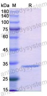 Recombinant Human PTPN2 Protein, N-His