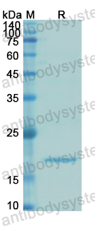 Recombinant Human IGFBP3 Protein, N-His