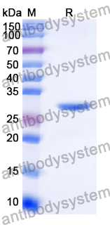 Recombinant Human IGFBP3 Protein, N-His