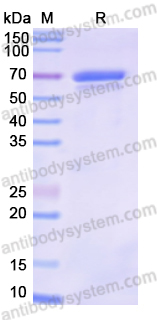 Recombinant Human TCP1/CCTA Protein, C-His