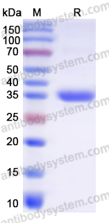 Recombinant Human PTPN1 Protein, N-His