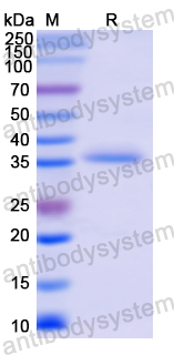 Recombinant Human ALOX12 Protein, N-His