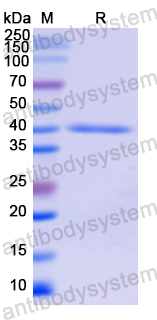 Recombinant Human LBP Protein, N-His