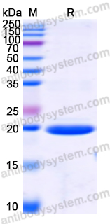 Recombinant Human IL1RN Protein, N-His