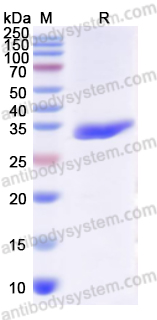 Recombinant Human PGAM1 Protein, N-His