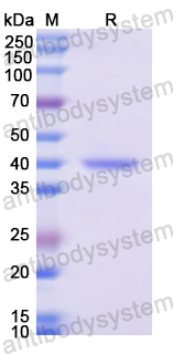 Recombinant Human ATF4 Protein, N-His