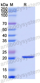 Recombinant Human ATF6 Protein, N-His-SUMO