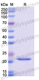 Recombinant Human LIG1 Protein, N-His