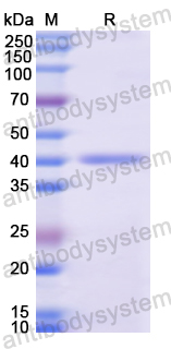 Recombinant Human XRCC1 Protein, N-His