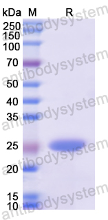 Recombinant Human KRT15 Protein, N-His