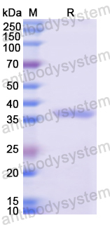 Recombinant Human KRT4 Protein, N-His