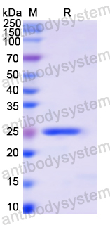 Recombinant Human PLCG1 Protein, N-His